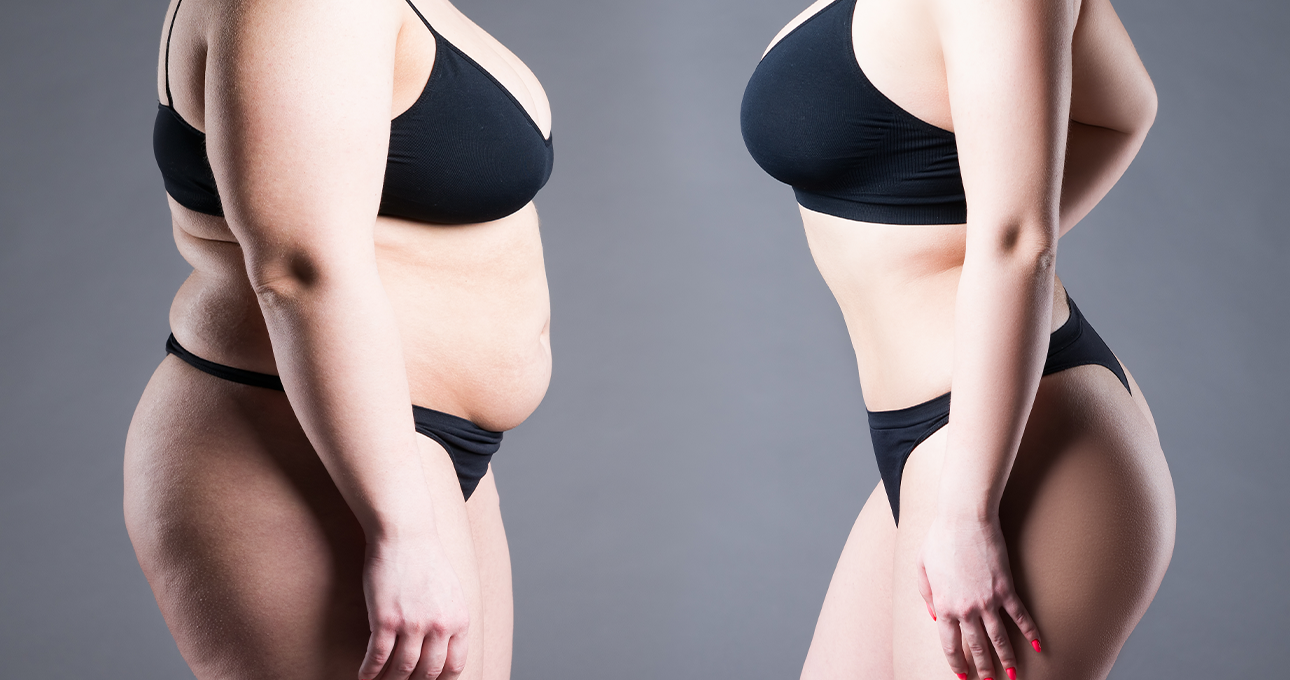 Weight Loss Versus Fat Loss